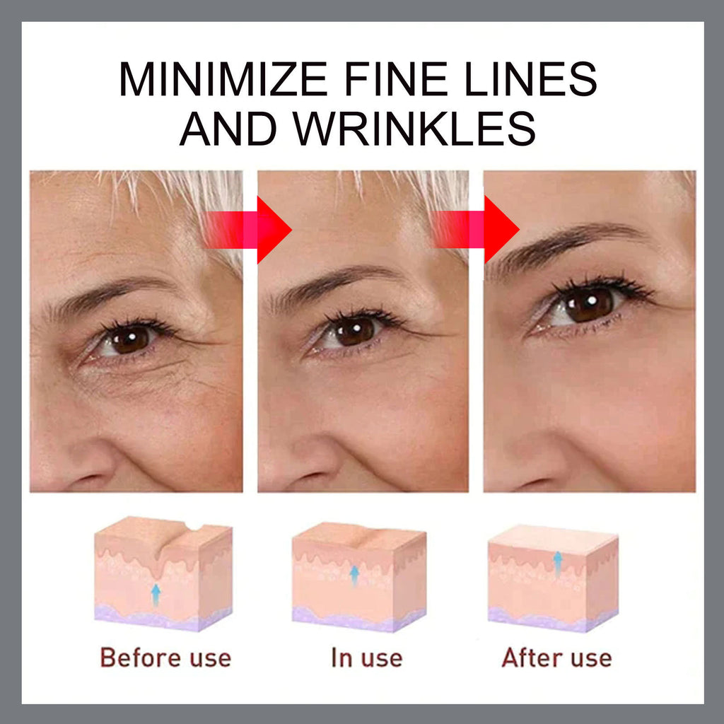 Hoygi Retinol Cream Fading Wrinkle Lifting And Firming